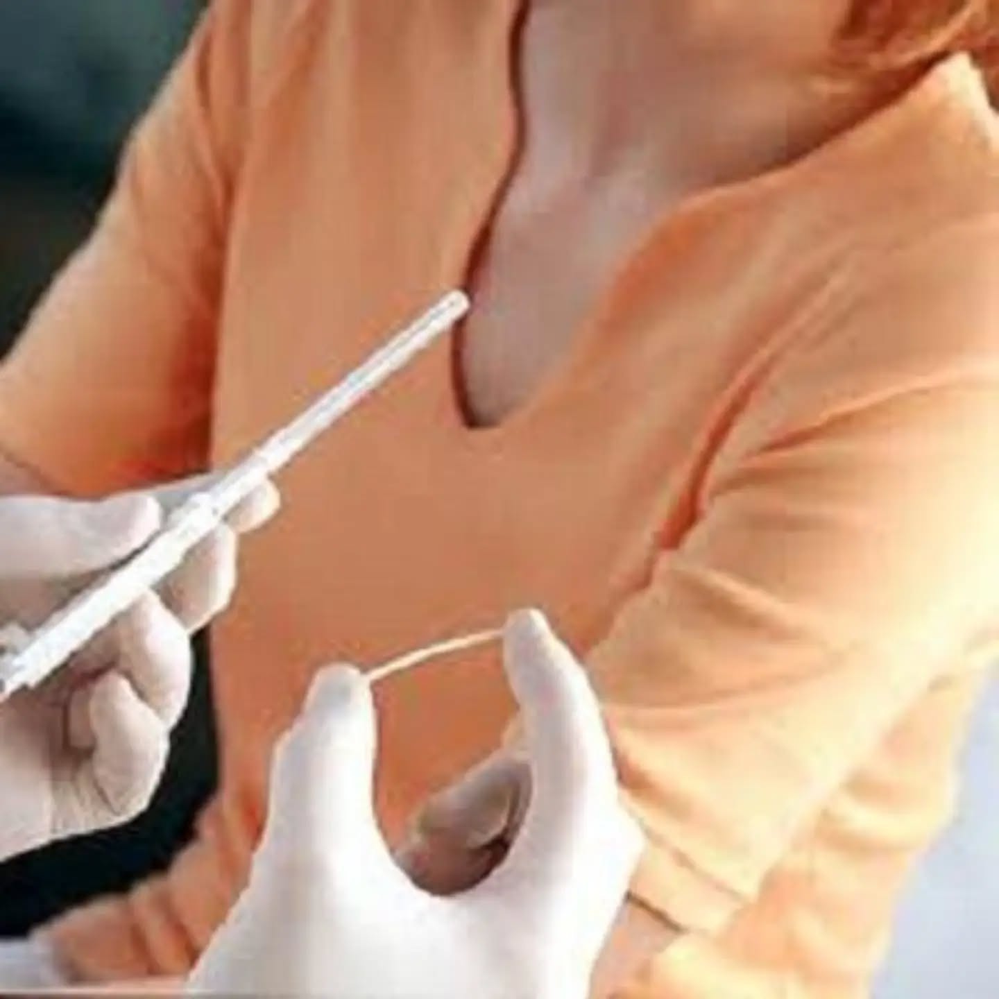 Инфекции, передающиеся половым путём